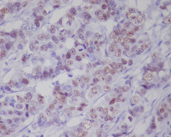 p53 (Phospho-Ser392) Rabbit mAb