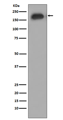 EGFR (Phospho-Tyr1068) Rabbit mAb  