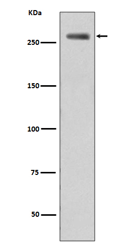 LRRK2 (Phospho-Ser935) Rabbit mAb 