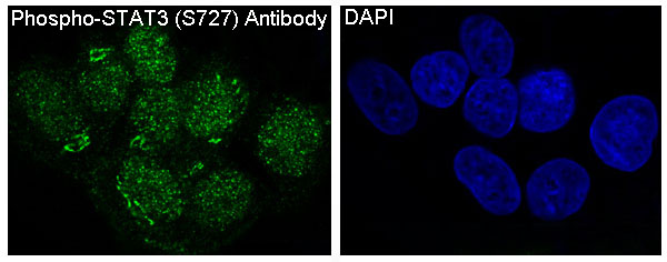 STAT3 (Phospho-Ser727) Rabbit mAb