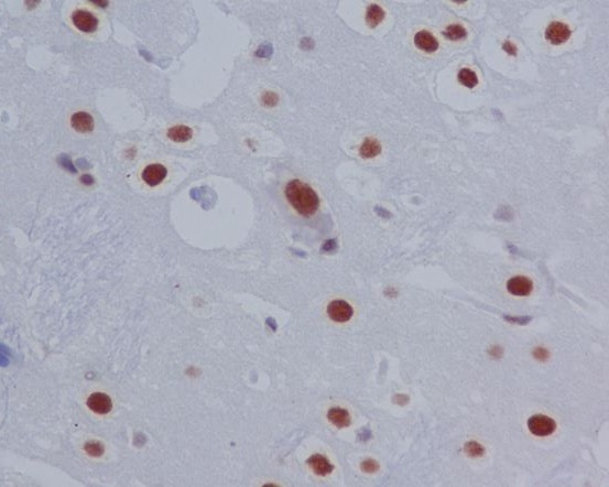 STAT3 (Phospho-Ser727) Rabbit mAb