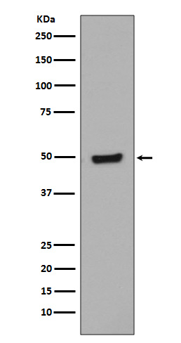 GATA3 (Phospho-Ser308) Rabbit mAb