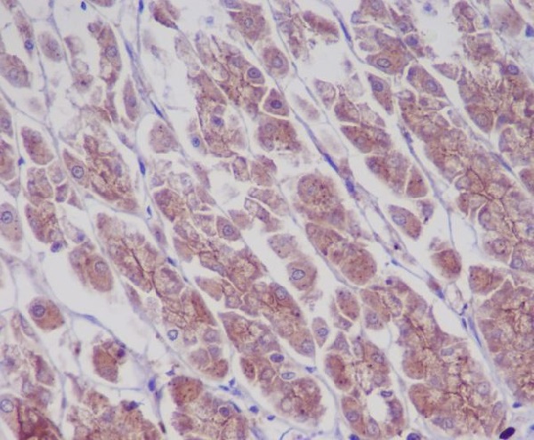 EGFR (Phospho-Y1197) Rabbit mAb