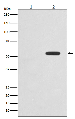 c-Myc (Phospho-Thr58) Rabbit mAb