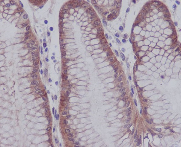 YAP1 (Phospho-Ser127) Rabbit mAb