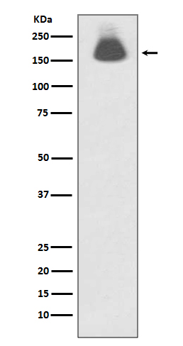 EGFR (Phospho-Ser695) Rabbit mAb