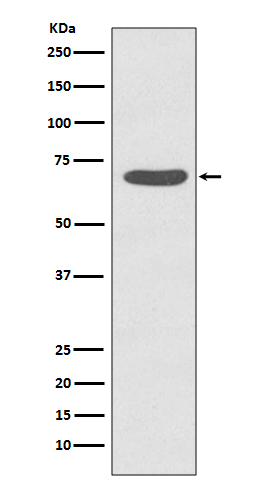 PKC zeta (Phospho-Thr560) Rabbit mAb