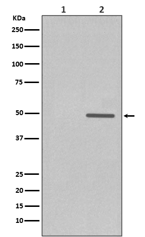 Cyclin E1 (Phospho-Thr77) Rabbit mAb