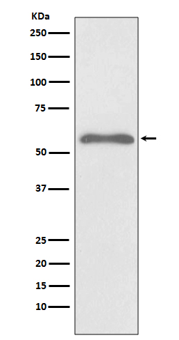 Smad2 (Phospho-Ser255) Rabbit mAb