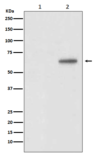 AKT1 (Phospho-Thr450) Rabbit mAb