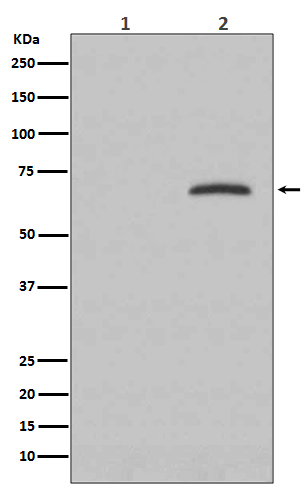 Paxillin (Phospho-Tyr118) Rabbit mAb