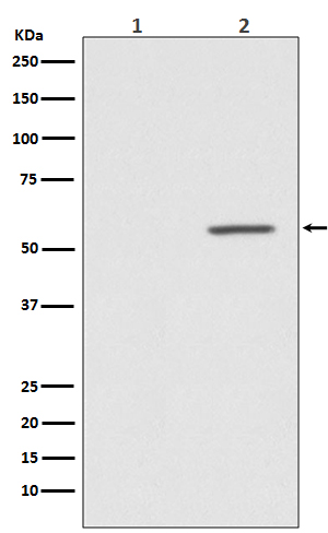 AKT1 (Phospho-Ser124) Rabbit mAb