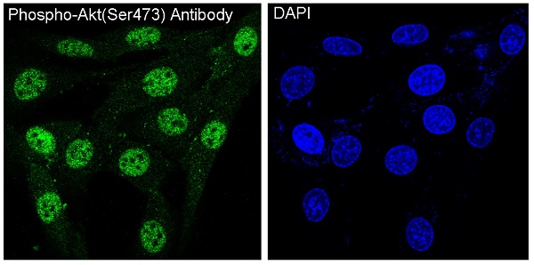 Akt(Phospho-Ser473) Rabbit mAb