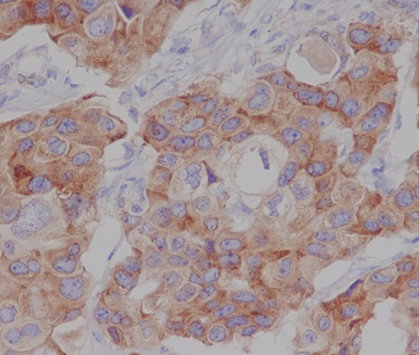 mTOR (Phospho-Ser2448) Rabbit mAb