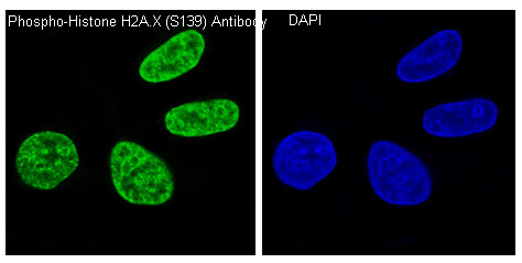 Histone H2A.X (Phospho-Ser139) Rabbit mAb