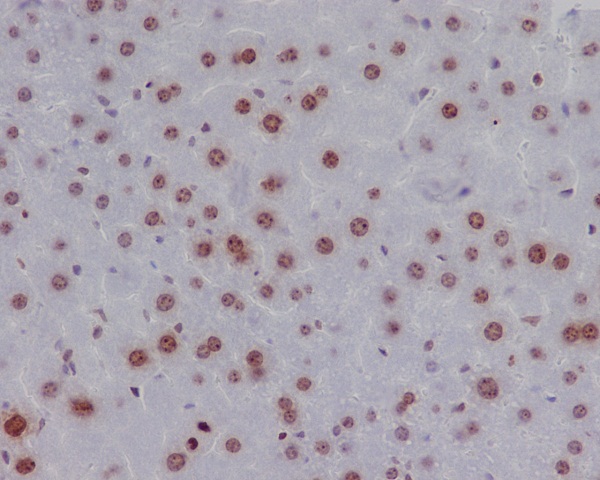 Histone H2A.X (Phospho-Ser139) Rabbit mAb