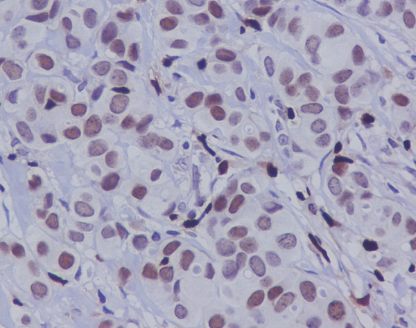 c-Jun (Phospho-Ser63) Rabbit mAb