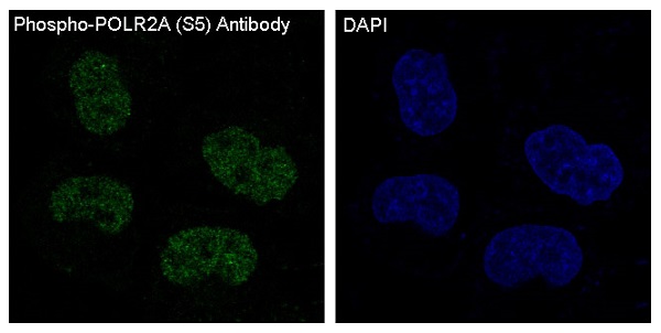 POLR2A (Phospho-Ser5) Rabbit mAb