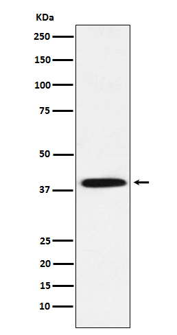 IKB alpha (Phospho-Ser36) Rabbit mAb