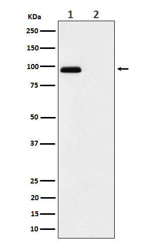 FGFR3 (Phospho-Tyr724) Rabbit mAb