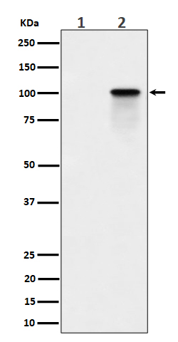 Nucleolin (Phospho-Thr84) Rabbit mAb