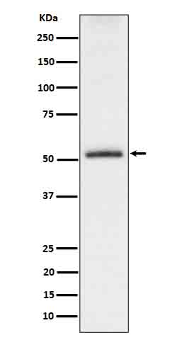 Tau (Phospho-Ser198) Rabbit mAb