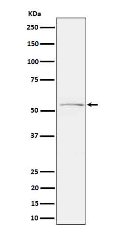 Tau (Phospho-Ser214) Rabbit mAb