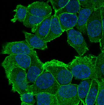 delta 1 Catenin/p120 Catenin Rabbit mAb