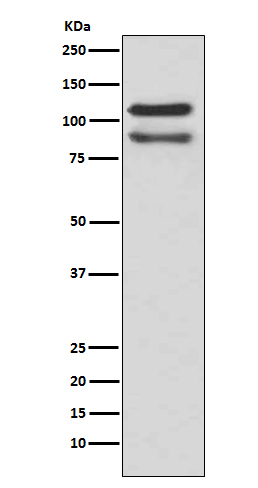 delta 1 Catenin/p120 Catenin Rabbit mAb