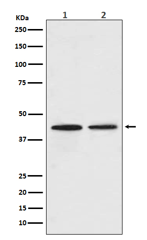 CCR9 Rabbit mAb