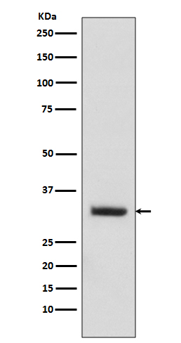 C10orf63 Rabbit mAb