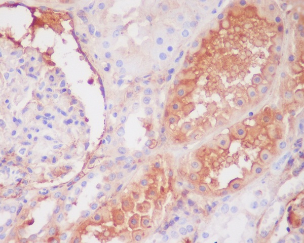 C9 Rabbit mAb