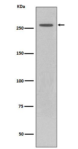 LRRK2 Rabbit mAb