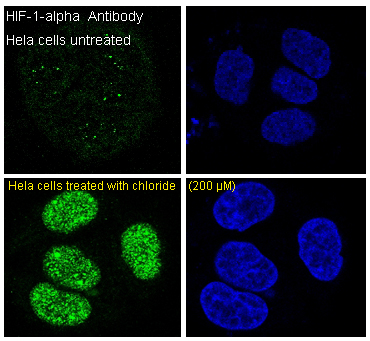 HIF-1 alpha Rabbit mAb