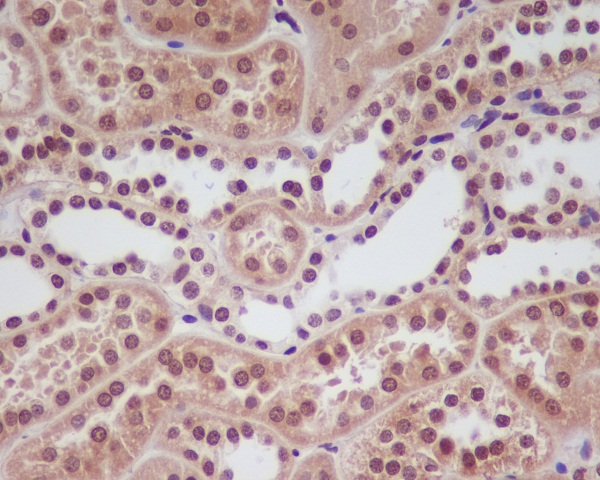 HIF-1 alpha Rabbit mAb