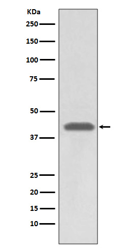 MHC class 1 Rabbit mAb