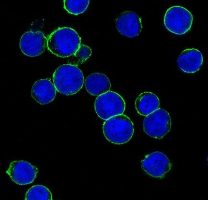 ErbB2 (HER2) Rabbit mAb