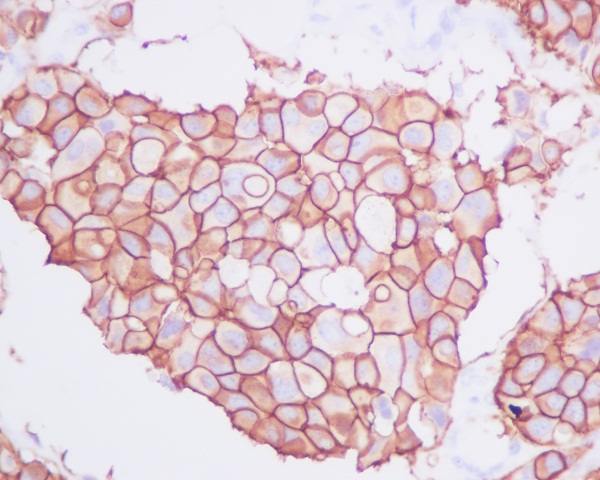 ErbB2 (HER2) Rabbit mAb