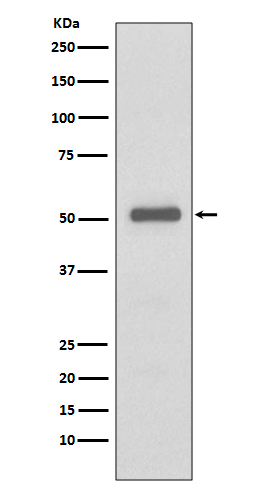 p57 Kip2 Rabbit mAb 