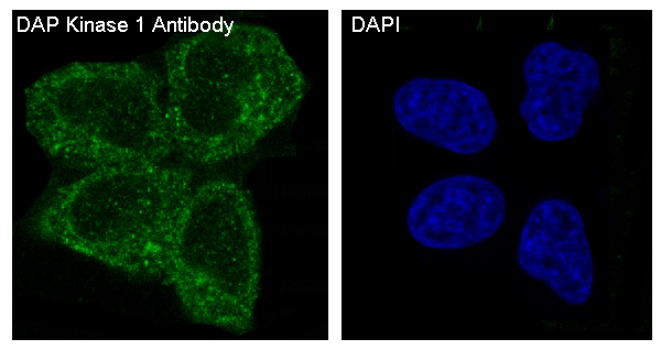 DAP Kinase 1 Rabbit mAb