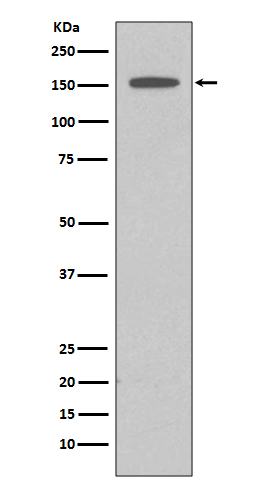 DAP Kinase 1 Rabbit mAb