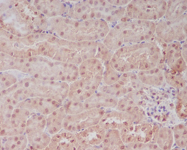 PELP1 Rabbit mAb