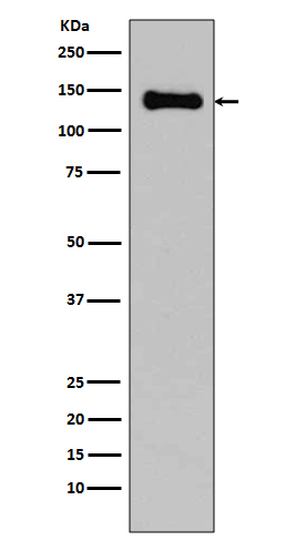 pan Cadherin Rabbit mAb  