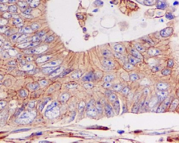 pan Cadherin Rabbit mAb  