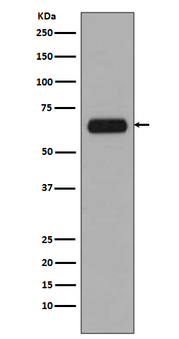 TCF3 Rabbit mAb