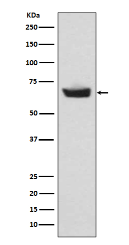 CETP Rabbit mAb