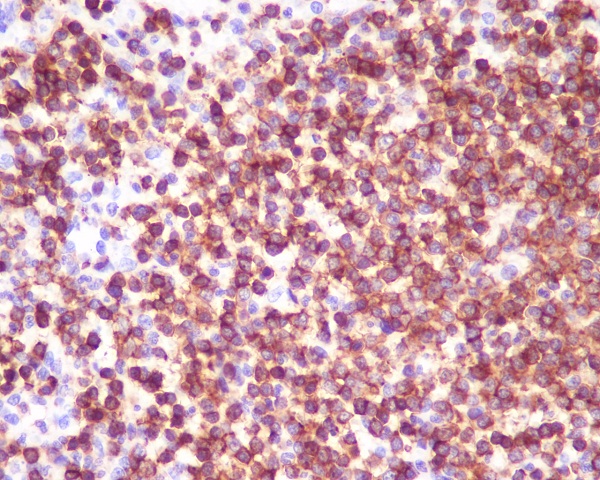 CD45 Rabbit mAb 