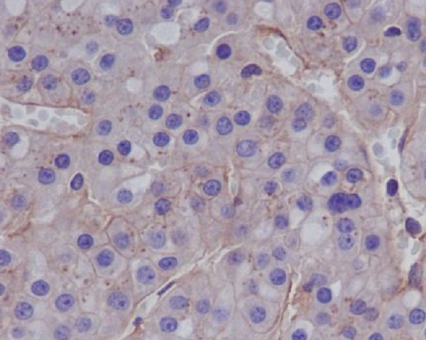 MMP1 Rabbit mAb