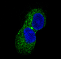 CaMKII Rabbit mAb