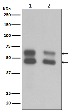 CaMKII Rabbit mAb